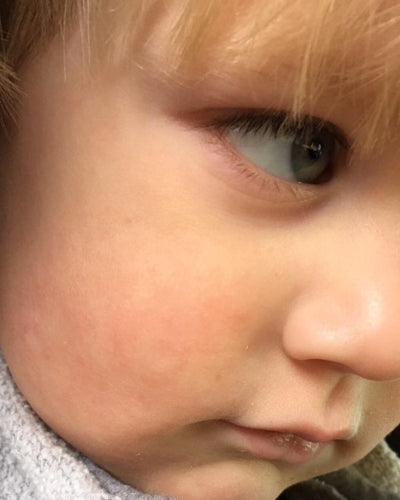 Close-up of a child's face with a focus on the eye.