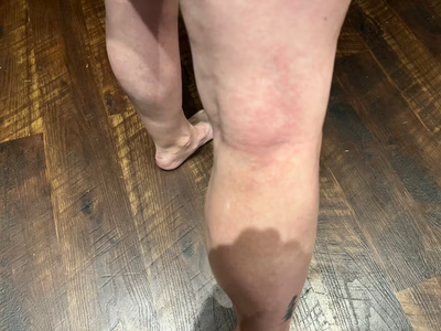 After result of a person's legs on a wooden floor