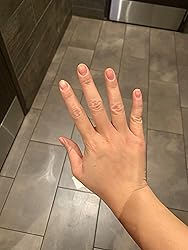 Hand with healed skin on a tiled floor