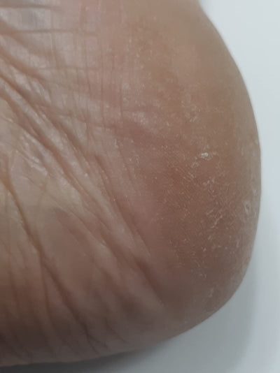 Close-up of a person's foot with visible skin texture on a white background