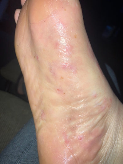 Close-up of a person's leg with visible skin conditions