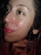 Close-up of a person with visible skin blemishes