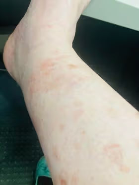 Close-up of a person's legs with visible skin texture and coloration.