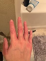 Hand with a skin rashes on a bathroom counter