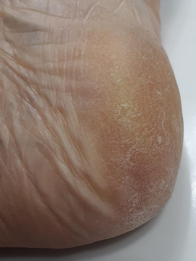 Close-up of a foot textured with dry skin