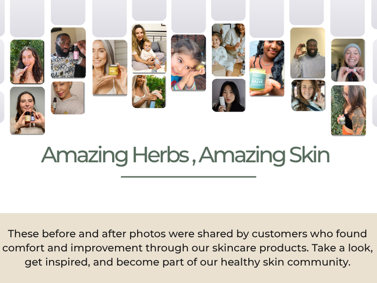 Collage of people with text 'Amazing Herbs, Amazing Skin' and 'Before and After' customer testimonials.