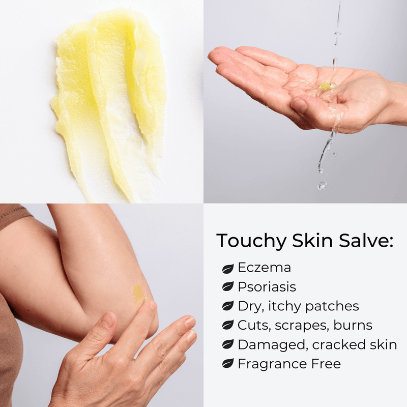 Touchy Skin Salve Eczema Cream Infographic What It Does