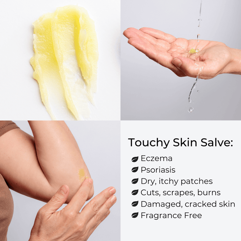 Touchy Skin Salve Infographic What It Does